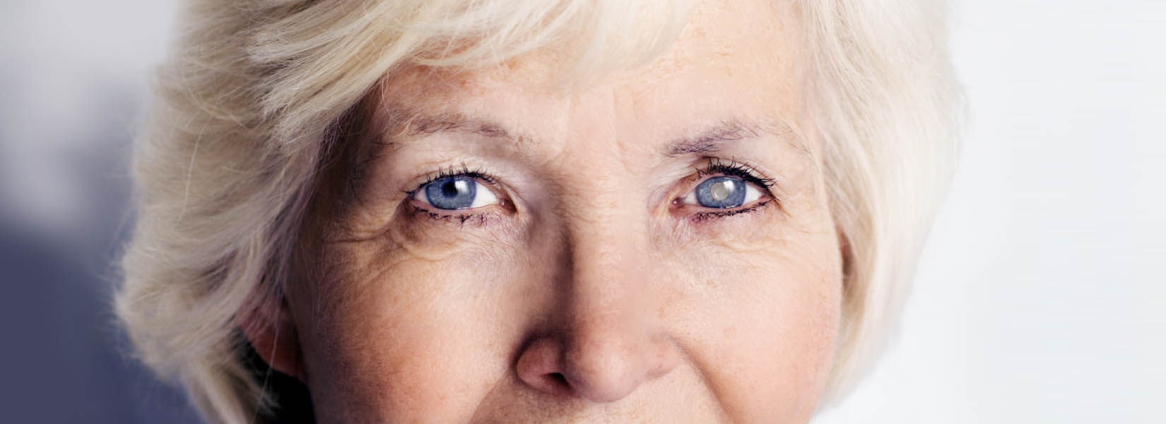 Cataract Surgery in Pleasant Hills