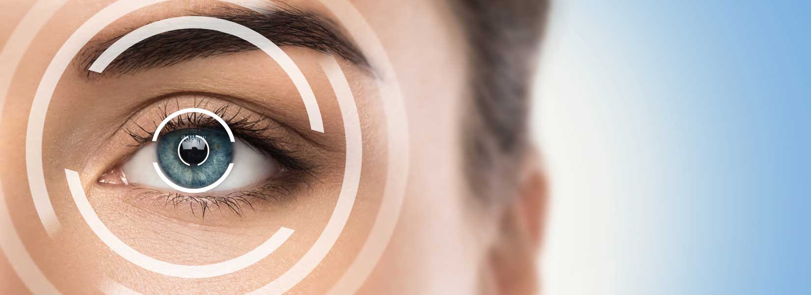 LASIK & Refractive Surgery Co-Management in Pleasant Hills