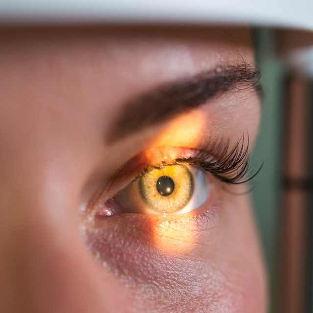 Vision Therapy in Pleasant Hills